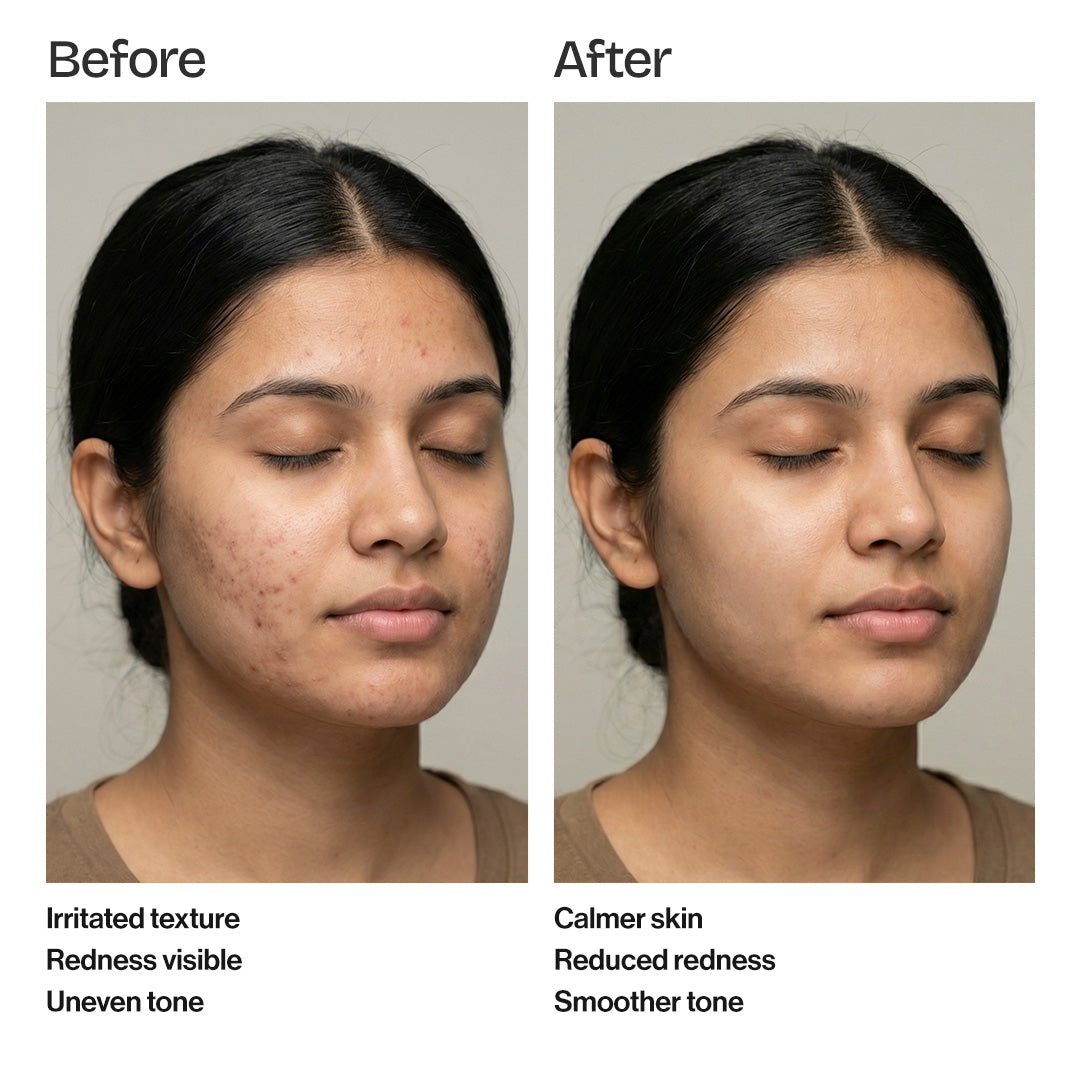 Chamomile Aloe 70% Ampoule