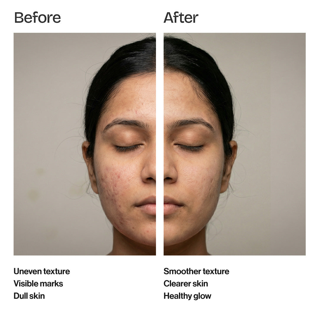 Tea Tree and Ginger 70% Ampoule