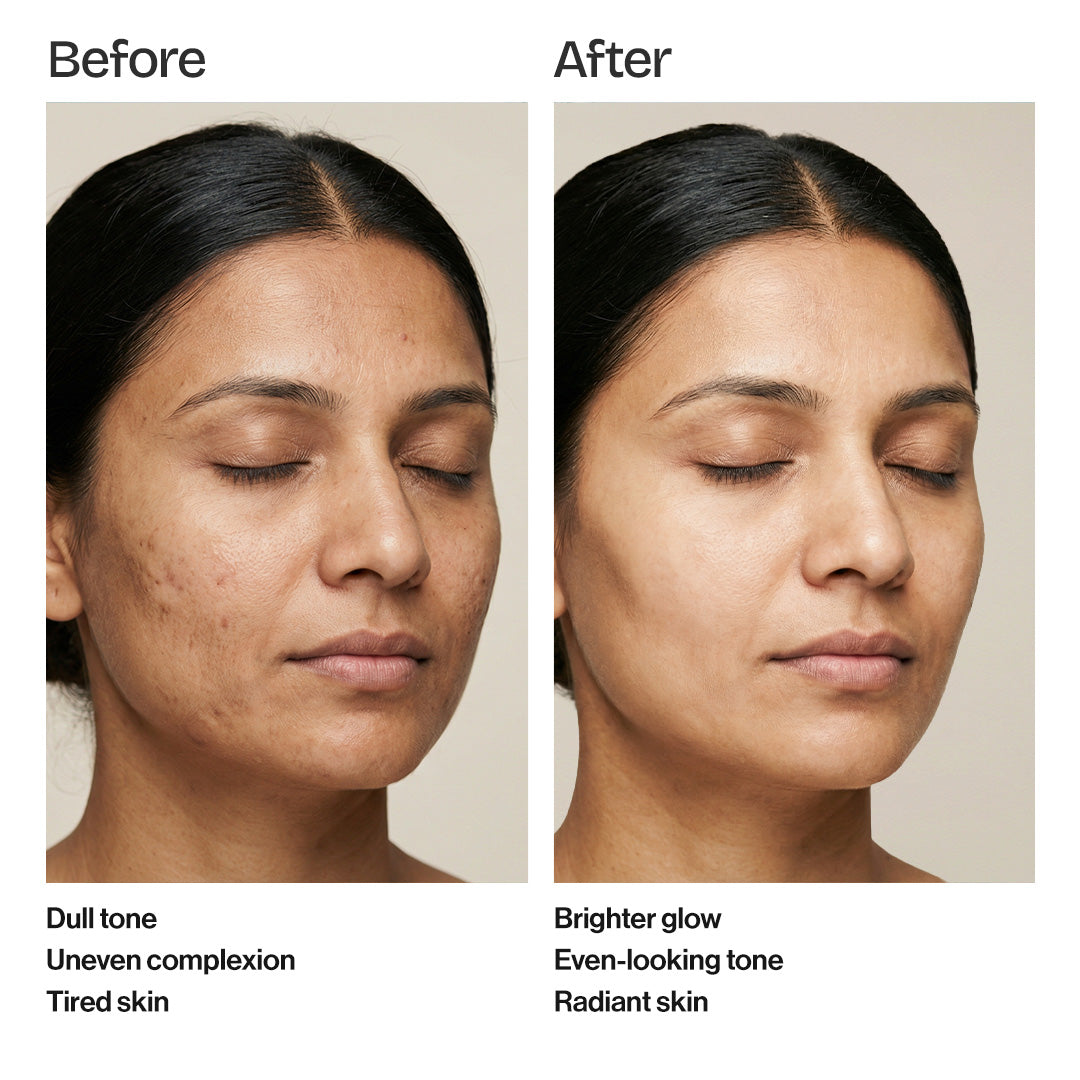 Vitamin C 20% Ampoule